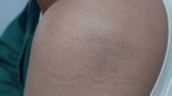 Pemanggilan Saksi Korban Suarni Sapikerep Dinilai Cermin Lambannya Penyidikan