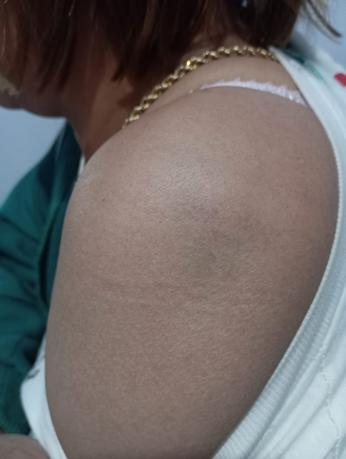 Pemanggilan Saksi Korban Suarni Sapikerep Dinilai Cermin Lambannya Penyidikan