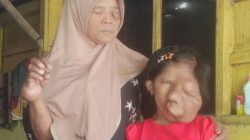 Mohon Bantuan ke Presiden RI Prabowo Subianto. Ibu & Anak Di Sragen Berjuang Melawan Kanker di Tengah Himpitan Ekonom