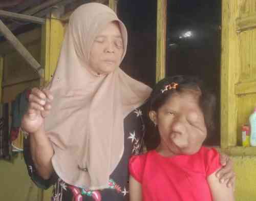 Mohon Bantuan ke Presiden RI Prabowo Subianto. Ibu & Anak Di Sragen Berjuang Melawan Kanker di Tengah Himpitan Ekonom